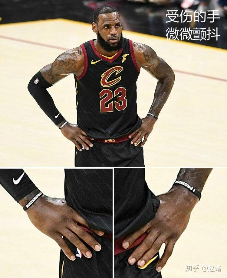 C罗与70激战MAD分钟圣安东尼奥马刺围绕德国杯临场应变，媒体一致点评：今晚亚特兰大调整名单以备欧联的简单介绍